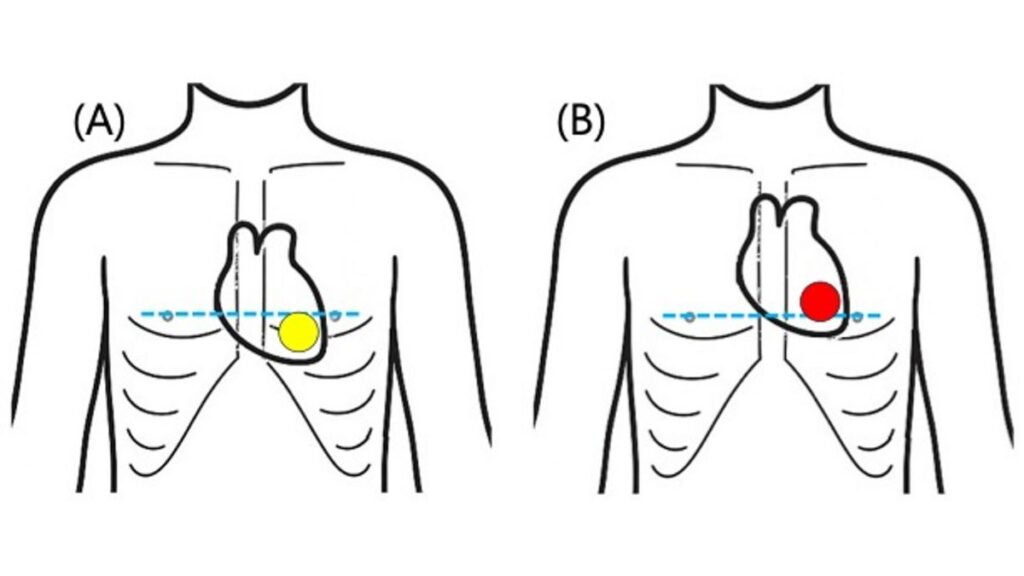 The Importance of the CPR Index in Assessing Cardiac Health