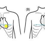 The Importance of the CPR Index in Assessing Cardiac Health